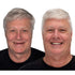 Affordable Removable Dentures with Flexible Cushion Grip Full Arch Set Cleaning - Image 11